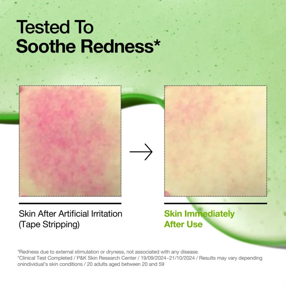 [ANUA] Azelaic Acid 10 Hyaluron Redness Soothing Serum – Image 6