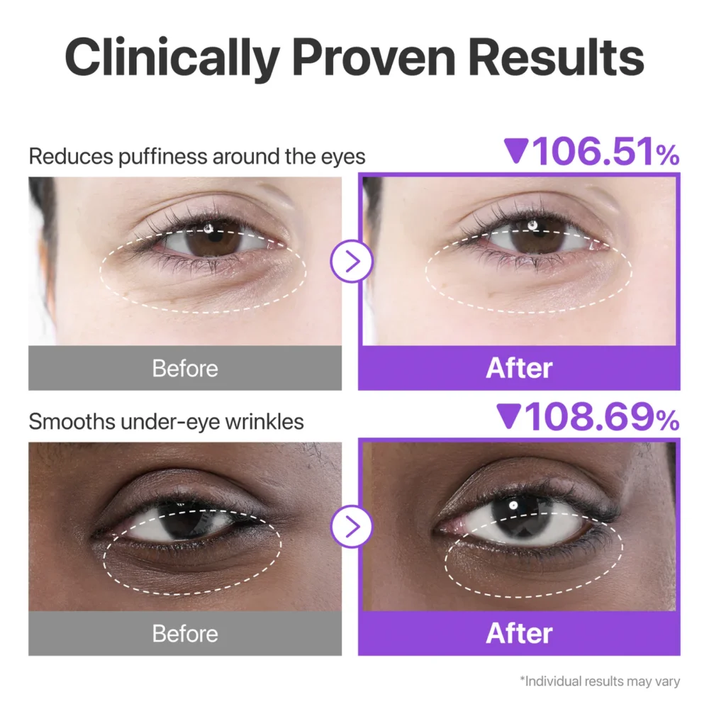 [NUMBUZIN] No.9 NAD+ Collagen Under Eye Patches (5 Pairs) – Image 4