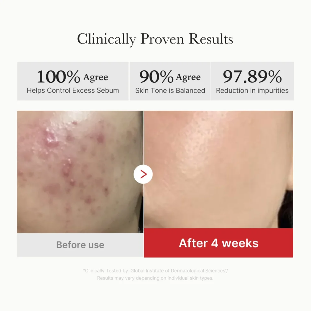 [Medicube] Red Succinic Acid Peeling Pad – Image 4